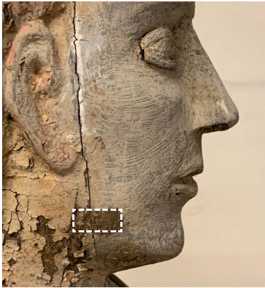 Fissure visage